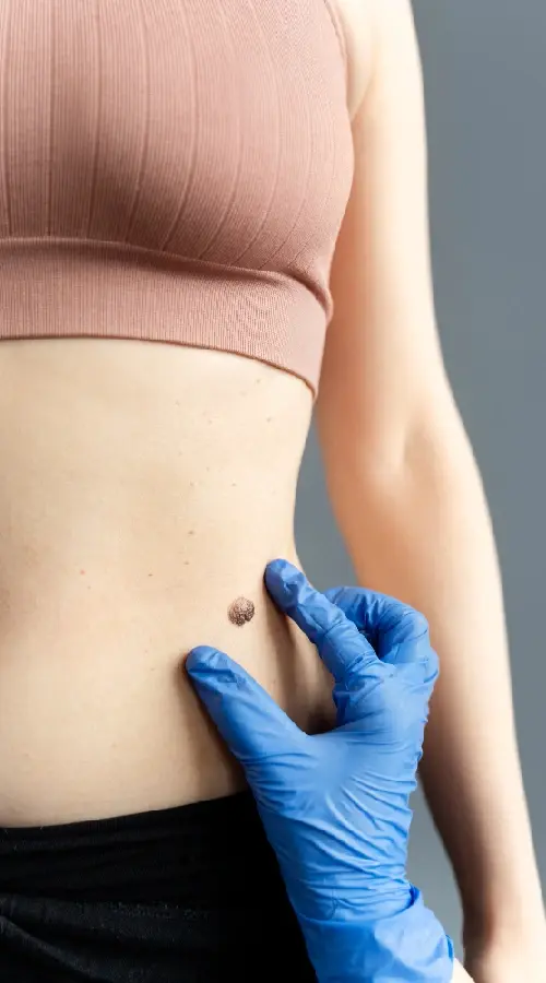 Complete Scar Tissue Pain Treatment in NYC